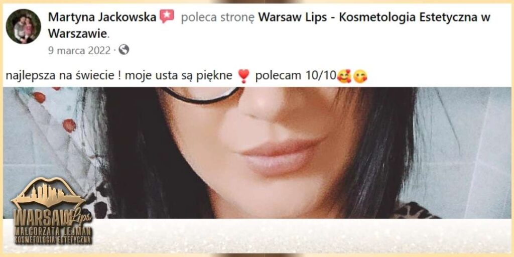 Warsaw Lips - Opinie klientek