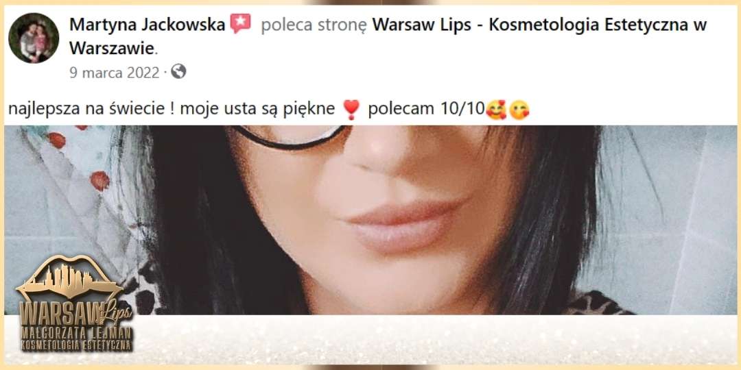 Warsaw Lips - Opinie klientek