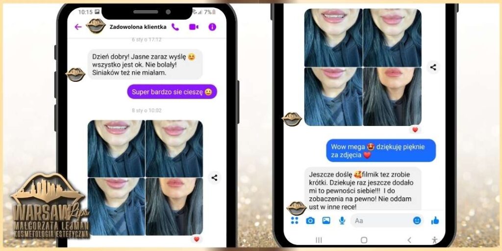 Warsaw Lips - Opinie klientek