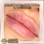 Efekty Warsaw Lips