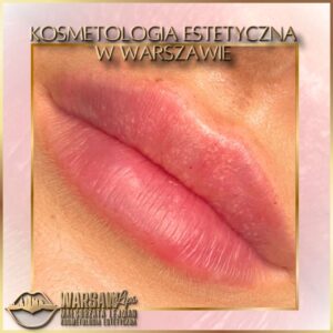 Efekty Warsaw Lips