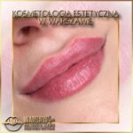 Efekty Warsaw Lips