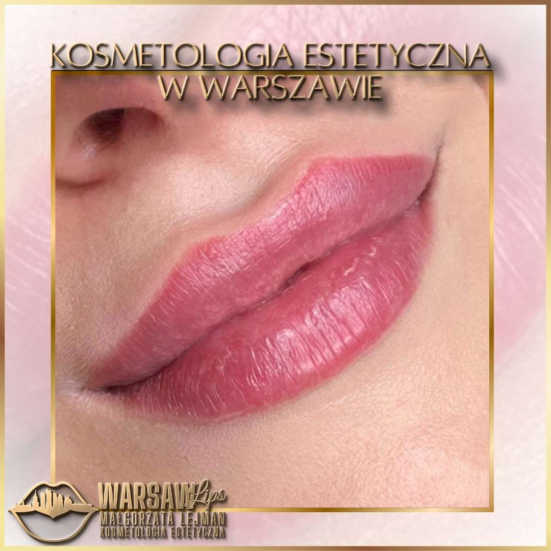 Efekty Warsaw Lips