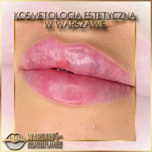 Efekty Warsaw Lips