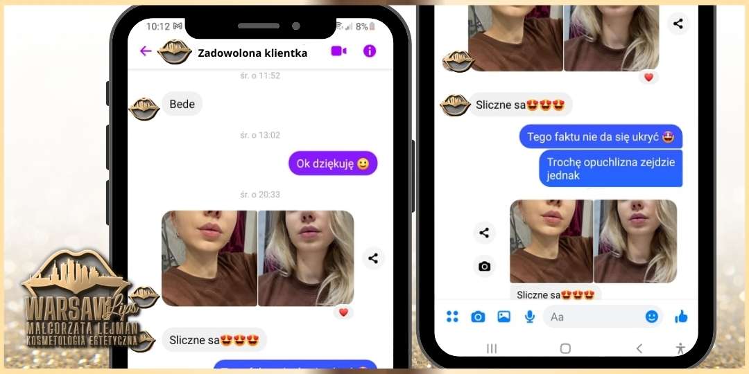 Warsaw Lips - Opinie klientek