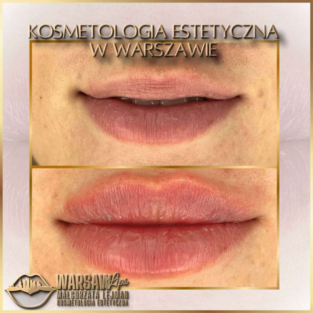 Warsaw Lips - Historia 2