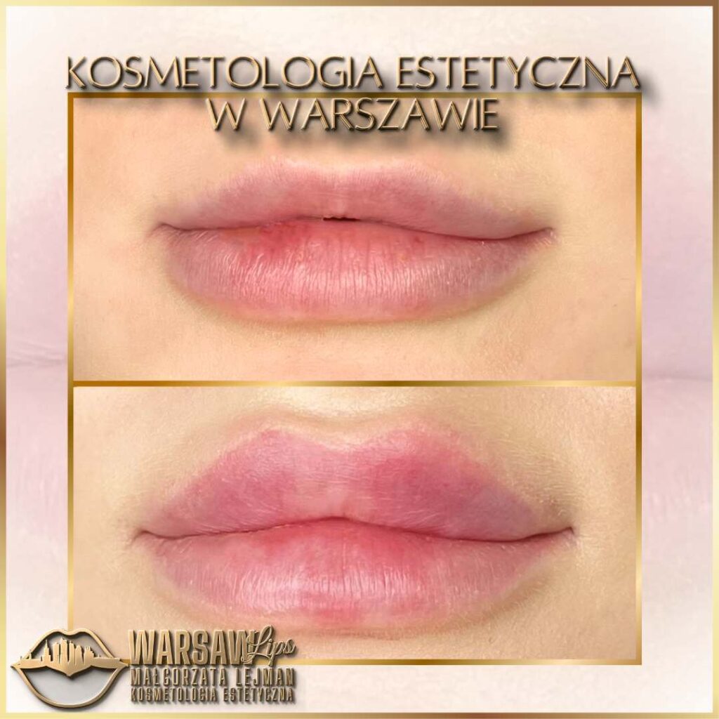 Warsaw Lips - Historia 3